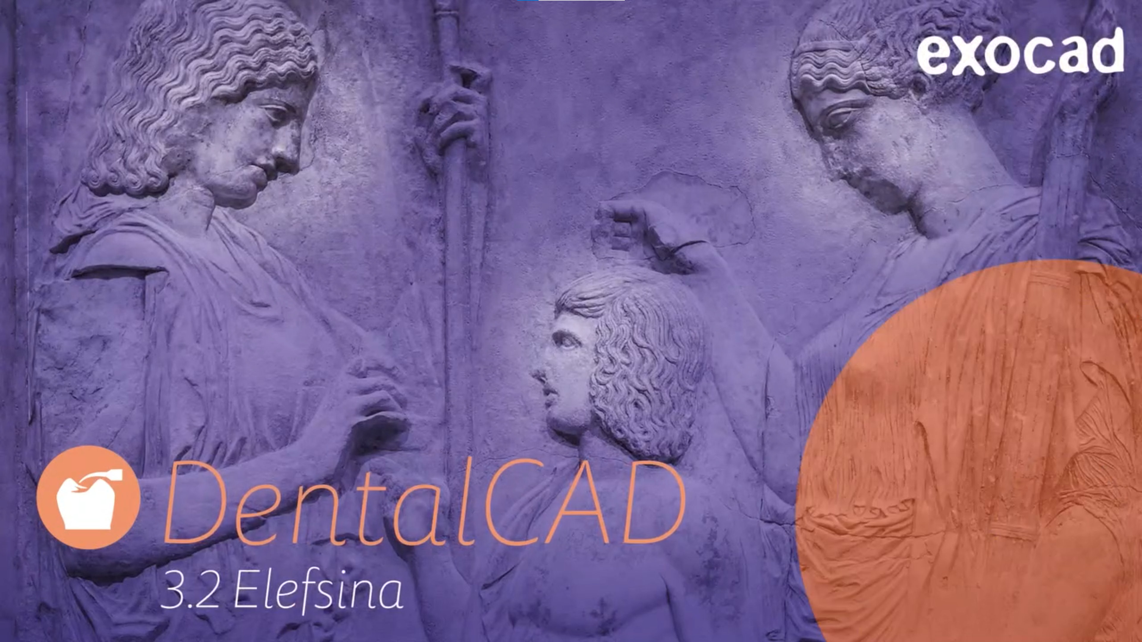 Με πάνω από 60 νέα χαρακτηριστικά το Exocad DentalCAD 3.2 Elefsina, είναι διαθέσιμο τώρα!